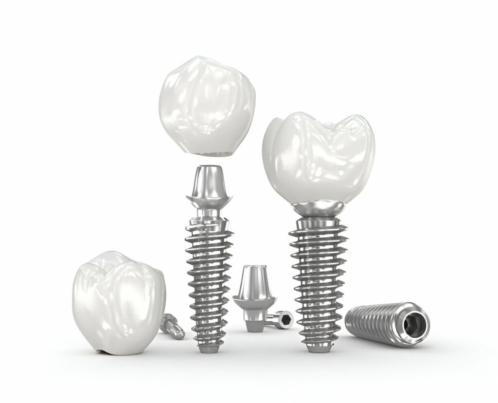 Dental Implant