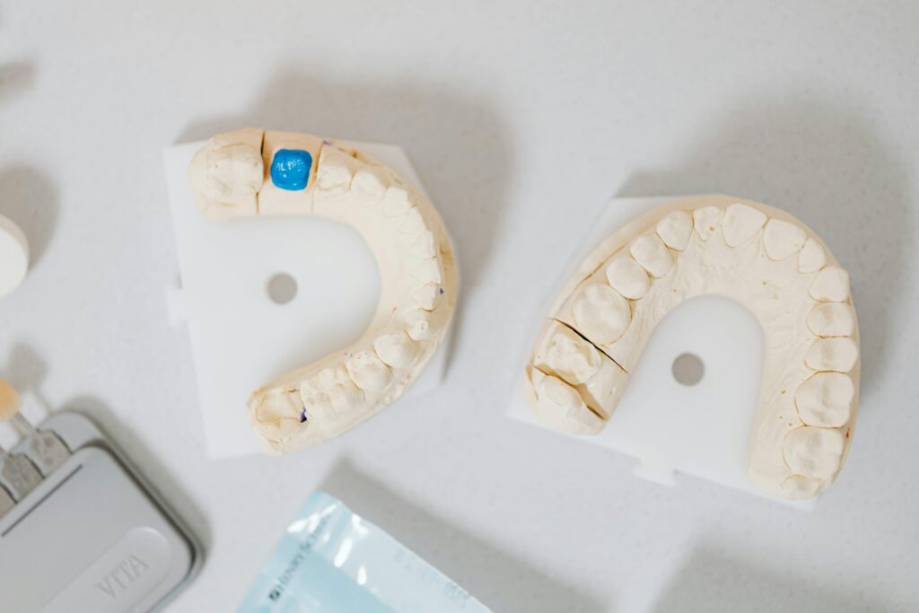 choose dental implant in aberdeen